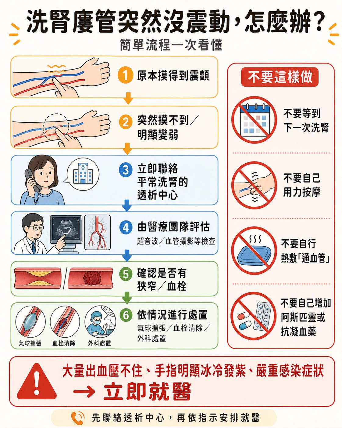 洗腎廔管堵塞處理流程，震顫消失後聯絡透析中心並評估狹窄血栓與通血管治療