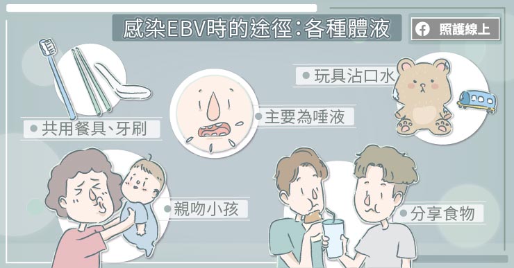 EBV皰疹病毒